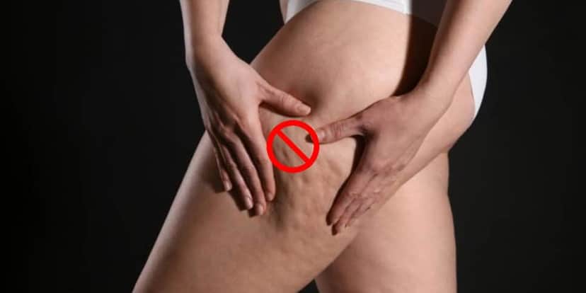 Adeus celulite com essa única bebida popular (Foto: Divulgação) Adeus celulite com essa única bebida popular (Foto: Divulgação)