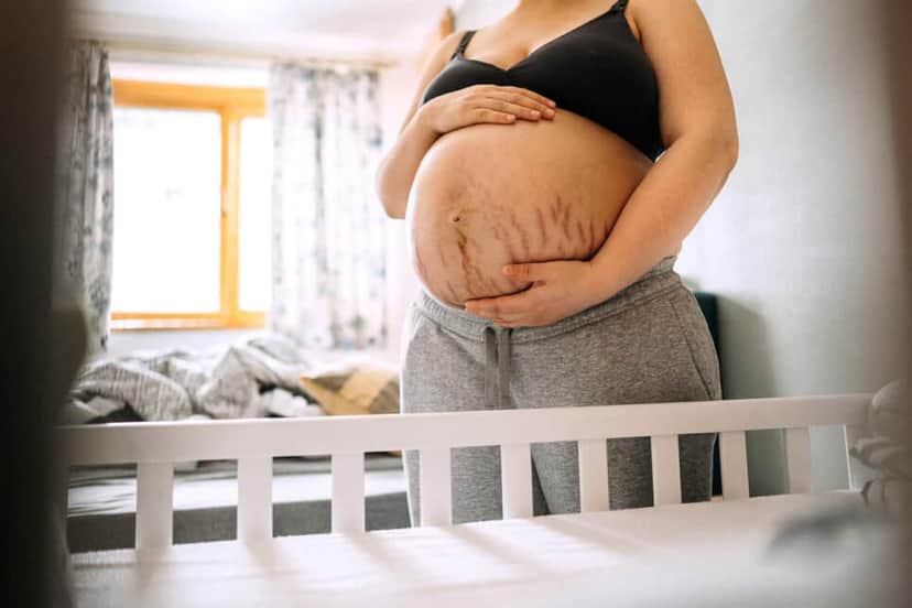 Tchau, marcas: 4 passos infalíveis para mulheres grávidas fugirem de estrias Tchau, marcas: 4 passos infalíveis para mulheres grávidas fugirem de estrias