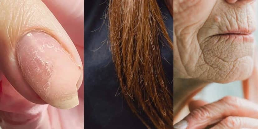 Falta de colágeno deixa unhas quebradiças, queda e quebra de cabelo e causa rugas (Foto Reprodução/Montagem/Tv Foco/Canva) Falta de colágeno deixa unhas quebradiças, queda e quebra de cabelo e causa rugas (Foto Reprodução/Montagem/Tv Foco/Canva)