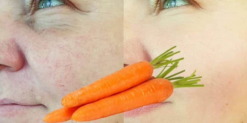 Harmonização facial caseira com cenoura para acabar com as rugas (Reprodução: Montagem TV Foco) Harmonização facial caseira com cenoura para acabar com as rugas (Reprodução: Montagem TV Foco)