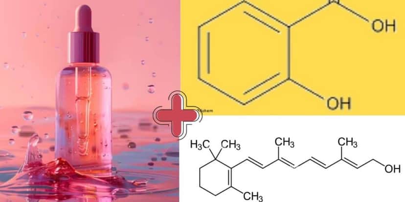 Combo de hidratante com Retinol + Ácido Salicílico (Foto Reprodução/Montagem/Tv Foco/Canva) Combo de hidratante com Retinol + Ácido Salicílico (Foto Reprodução/Montagem/Tv Foco/Canva)