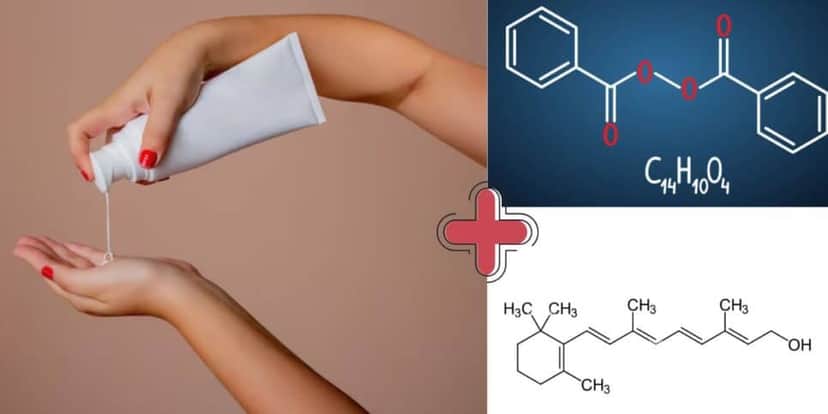 Combo de hidratante com Retinol + Peróxido de Benzoíla (Foto Reprodução/Montagem/Tv Foco/Canva) Combo de hidratante com Retinol + Peróxido de Benzoíla (Foto Reprodução/Montagem/Tv Foco/Canva)