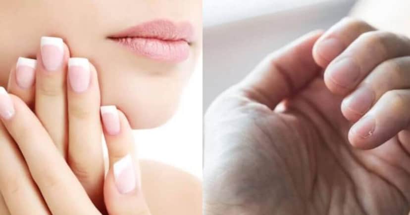 Saiba receita para evitar unhas quebradas Saiba receita para evitar unhas quebradas