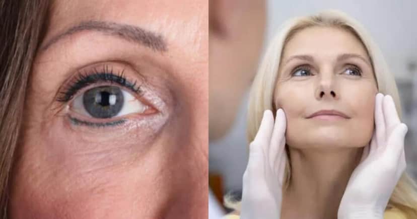 Graças a essa receita, você terá sua própria harmonização facial caseira (Foto: Montagem) Graças a essa receita, você terá sua própria harmonização facial caseira (Foto: Montagem)
