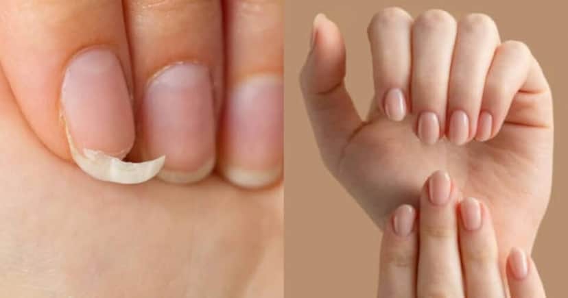 Fim da quebra: 5 alimentos deixam unhas gigantes no Ano Novo (Foto: Reprodução/iStock/Montagem TV Foco) Fim da quebra: 5 alimentos deixam unhas gigantes no Ano Novo (Foto: Reprodução/iStock/Montagem TV Foco)
