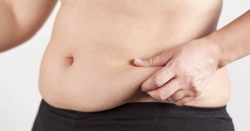 Gordura Abdominal chegará ao fim (Foto: Divulgação) Gordura Abdominal chegará ao fim (Foto: Divulgação)