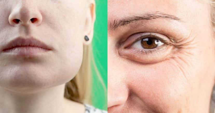 Peeling caseiro com 2 ingredientes afina o rosto e suga rugas (Reprodução/Montagem TV Foco/Canva) Peeling caseiro com 2 ingredientes afina o rosto e suga rugas (Reprodução/Montagem TV Foco/Canva)