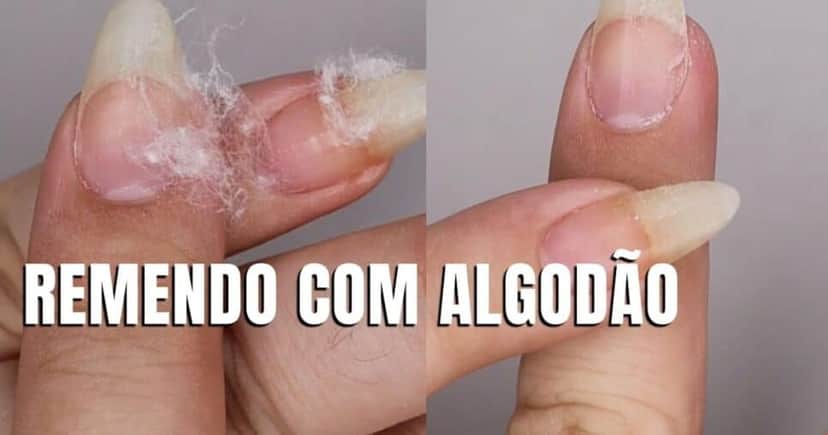 Remendo com algodão (Reprodução/Youtube) Remendo com algodão (Reprodução/Youtube)