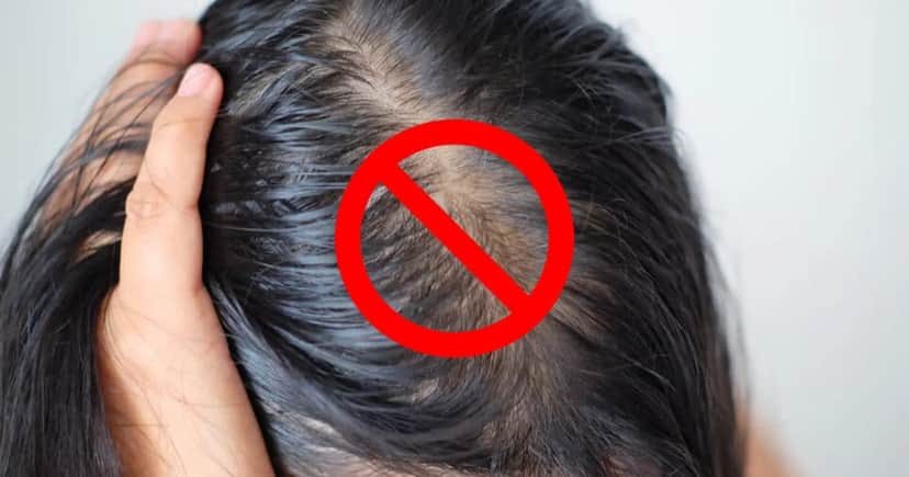 É possível dizer adeus ao cabelo oleoso com esses 5 ingredientes (Foto: Montagem) É possível dizer adeus ao cabelo oleoso com esses 5 ingredientes (Foto: Montagem)