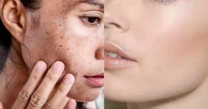 Milagre da juventude: Mistura natural com 2 ingredientes some com rugas e deixa pele lisinha igual ao botox - Foto: Internet Milagre da juventude: Mistura natural com 2 ingredientes some com rugas e deixa pele lisinha igual ao botox - Foto: Internet