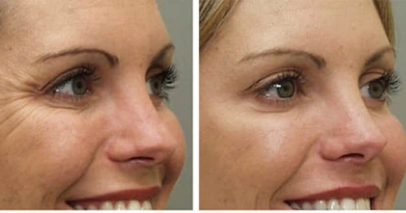 Colágeno caseiro com 2 ingredientes traz creme facial potente - (Foto: Internet) Colágeno caseiro com 2 ingredientes traz creme facial potente - (Foto: Internet)