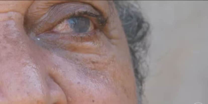 Idosa com catarata (Foto: Reprodução / Globo)