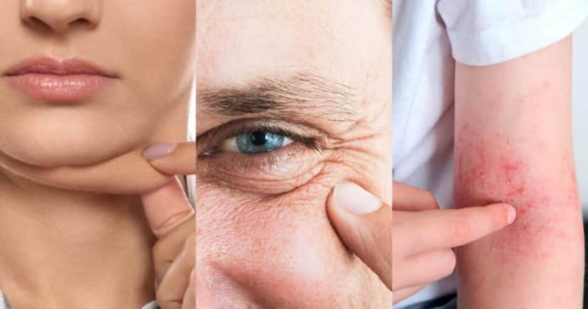 misturas com ingredientes populares trazem botox natural - (Montagem / TV FOCO) misturas com ingredientes populares trazem botox natural - (Montagem / TV FOCO)