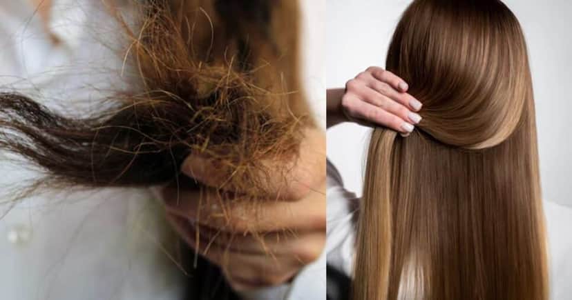 Cabelo ressecado e liso (Fotos: Freepik) Cabelo ressecado e liso (Fotos: Freepik)