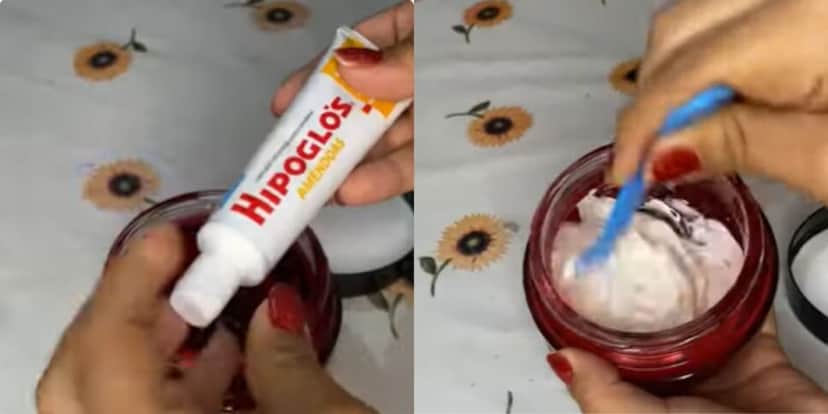 Botox caseiro para acabar com as rugas (Reprodução: Youtube) Botox caseiro para acabar com as rugas (Reprodução: Youtube)