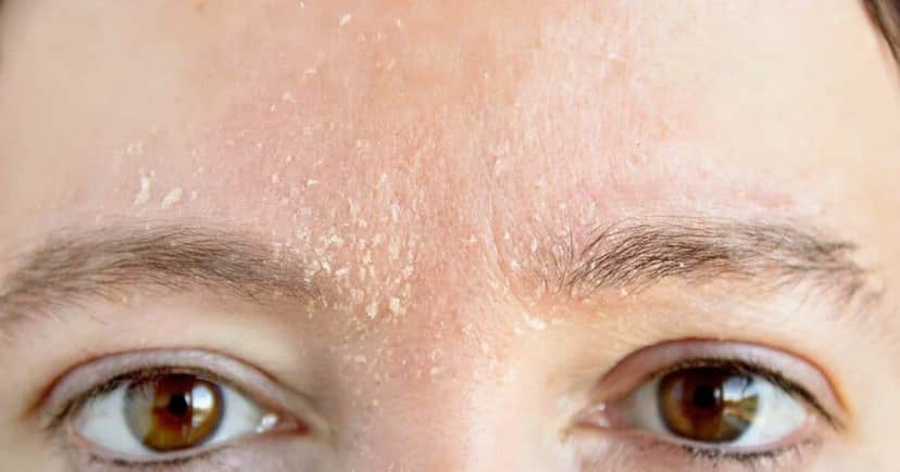 Dermatologista cuidado da pele http://tvfoco.uai.com.br/wp-content/uploads/2015/05/Daniela-Mercury.jpg Dermatologista cuidado da pele http://tvfoco.uai.com.br/wp-content/uploads/2015/05/Daniela-Mercury.jpg