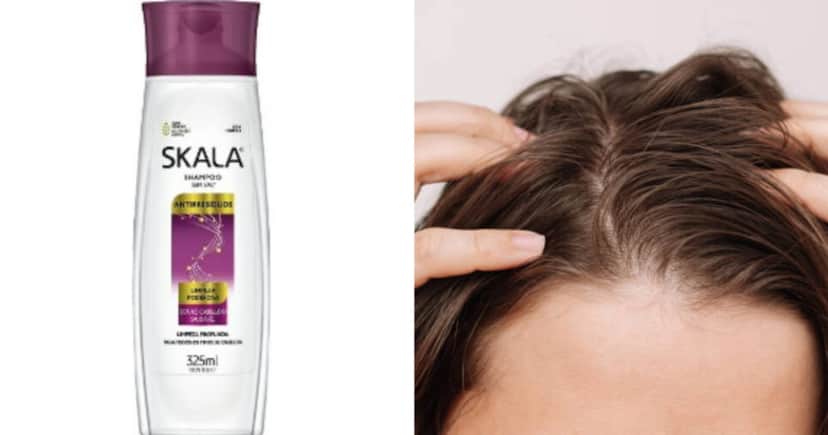 Conheça o shampoo para cabelos oleosos (Foto: Montagem TV Foco) Conheça o shampoo para cabelos oleosos (Foto: Montagem TV Foco)