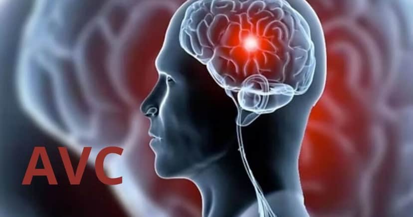 Acidente Vascular Cerebral (AVC) - Foto: Internet Acidente Vascular Cerebral (AVC) - Foto: Internet