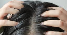 Cabelo oleoso? Cuidados simples para manter os fios limpos por mais tempo