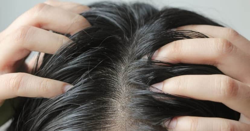 Cabelo oleoso (Foto: Canva) Cabelo oleoso (Foto: Canva)