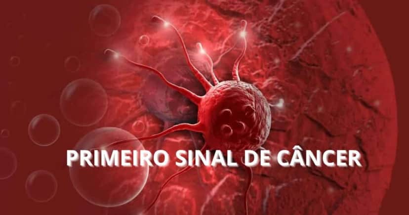 Câncer - Foto Internet Câncer - Foto Internet