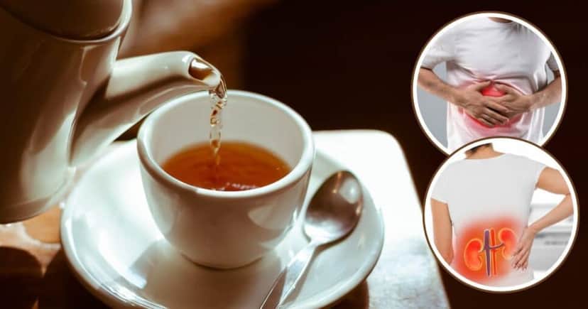 Chá natural elimina a gordura no fígado e melhora a função renal (Foto: Reprodução / Canva / Montagem TV Foco) Chá natural elimina a gordura no fígado e melhora a função renal (Foto: Reprodução / Canva / Montagem TV Foco)