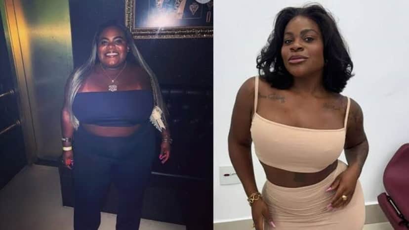 Jojo Todynho antes e depois da bariátrica (Foto: Reprodução/ Instagram/ Montagem) Jojo Todynho antes e depois da bariátrica (Foto: Reprodução/ Instagram/ Montagem)
