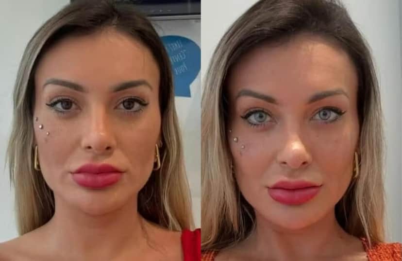 Andressa Urach fala sobe procedimento arriscado (Foto: Reprodução/Montagem) Andressa Urach fala sobe procedimento arriscado (Foto: Reprodução/Montagem)