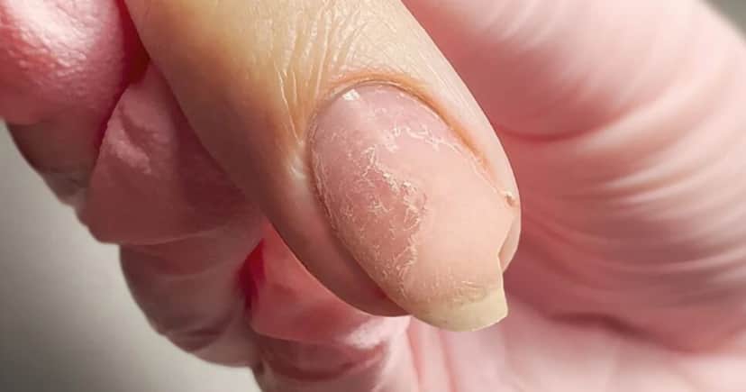 Unhas - Foto: Internet Unhas - Foto: Internet