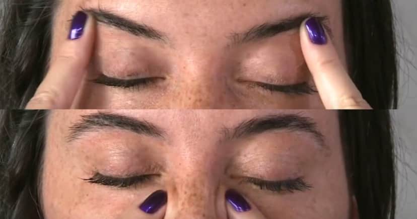 Círculos ao redor dos olhos- Foto: YouTube Círculos ao redor dos olhos- Foto: YouTube
