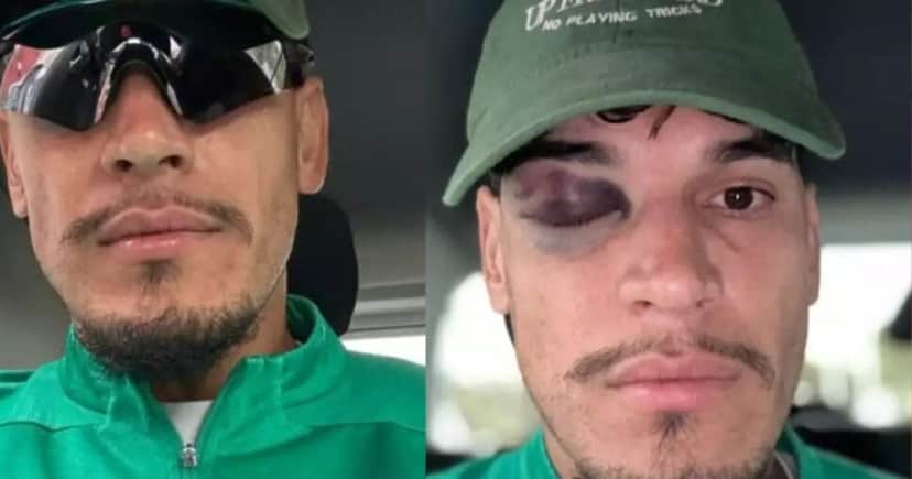 Gustavo Gómez posta foto com olho roxo - Foto: Instagram Gustavo Gómez posta foto com olho roxo - Foto: Instagram