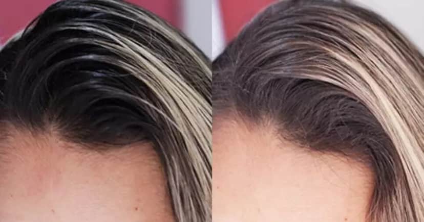 Esse é o segredo para acabar com a oleosidade - Foto: Internet Esse é o segredo para acabar com a oleosidade - Foto: Internet