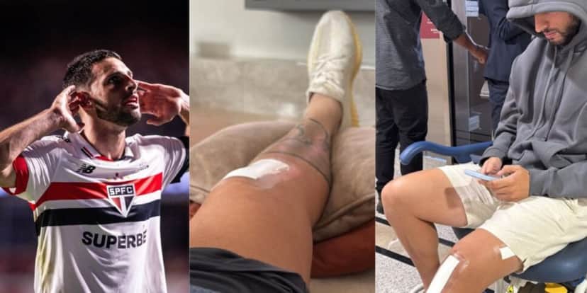 Calleri segueem recuperação da lesão (Reprodução: Instagram) Calleri segueem recuperação da lesão (Reprodução: Instagram)