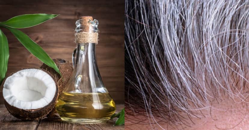 Óleo de coco para escurecer os cabelos brancos e atua como tinta caseira (Foto: Divulgação) Óleo de coco para escurecer os cabelos brancos e atua como tinta caseira (Foto: Divulgação)