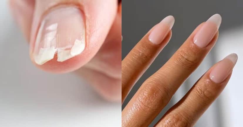 Unhas fortes e bem cuidadas (Foto: Divulgação) Unhas fortes e bem cuidadas (Foto: Divulgação)