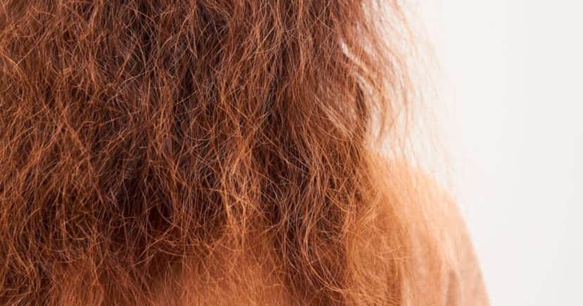 Cabelo seco e quebradiço (Foto: Reprodução/ Internet) Cabelo seco e quebradiço (Foto: Reprodução/ Internet)