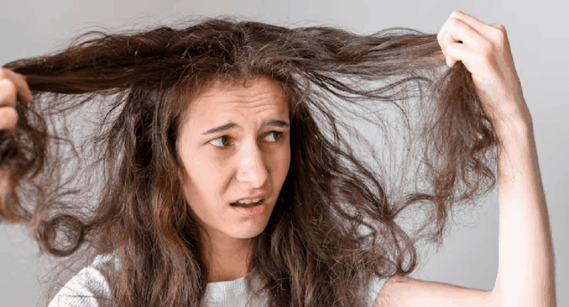 Cabelos com frizz (Foto: Reprodução/Freepik) Cabelos com frizz (Foto: Reprodução/Freepik)