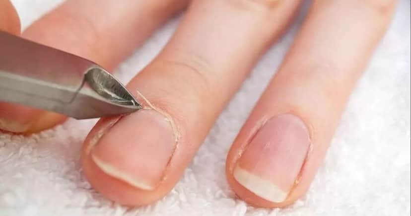Cutículas unhas - Foto; Montagem Cutículas unhas - Foto; Montagem