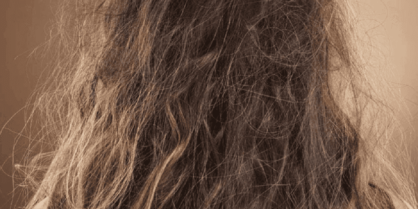 Cabelo com nó, frizz e pontas duplas (Foto: Reprodução/Internet) Cabelo com nó, frizz e pontas duplas (Foto: Reprodução/Internet)
