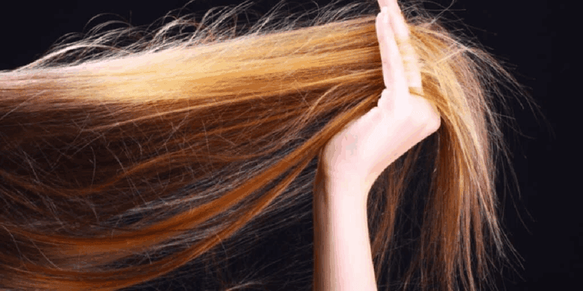 Cabelo com frizz (Foto: Reprodução/Internet) Cabelo com frizz (Foto: Reprodução/Internet)