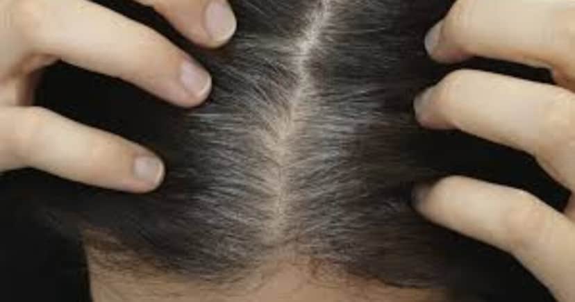Saiba o que fazer para cobrir seus cabelos brancos em casa (Foto: Divulgação) Saiba o que fazer para cobrir seus cabelos brancos em casa (Foto: Divulgação)