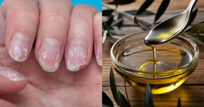Unhas inquebráveis com azeite (Foto: Divulgação) Unhas inquebráveis com azeite (Foto: Divulgação)