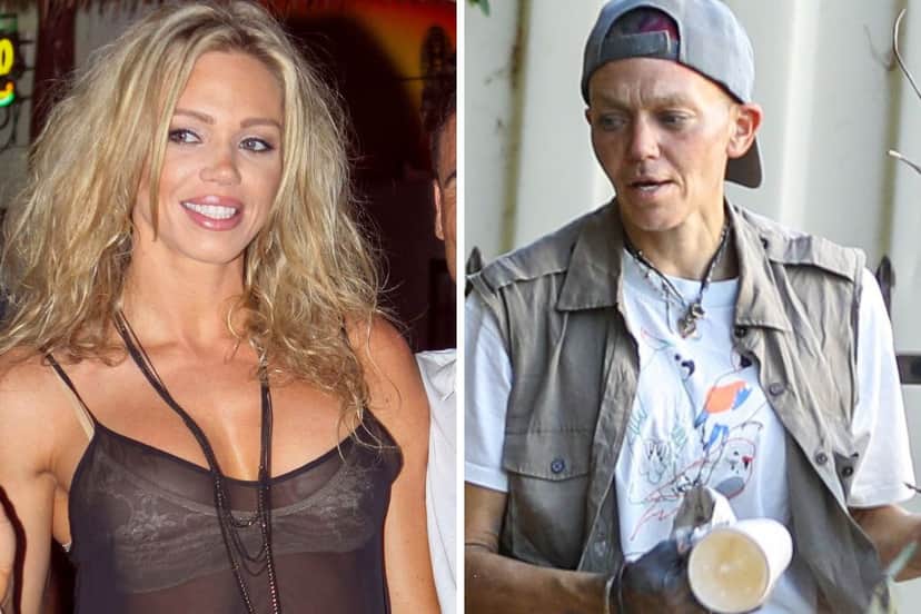 Antes e depois da ex-modelo Loni Willison (Foto: Reprodução/ Internet)