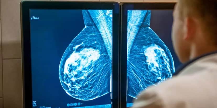 Mamografia é fundamental na prevenção do câncer de mama (Reprodução: Divulgação) Mamografia é fundamental na prevenção do câncer de mama (Reprodução: Divulgação)