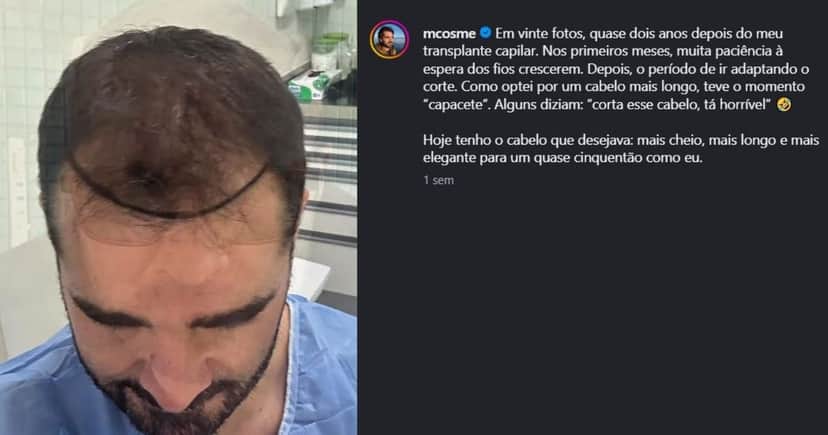 Postagem recente sobre o transplante de Marcelo Cosme (Foto Reprodução/Instagram) Postagem recente sobre o transplante de Marcelo Cosme (Foto Reprodução/Instagram)