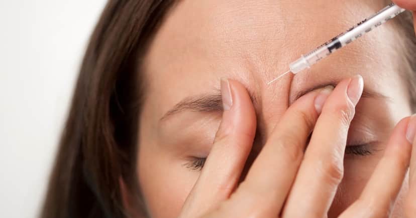 Acabe com as rugas na testa sem botox (Foto: Divulgação) Acabe com as rugas na testa sem botox (Foto: Divulgação)