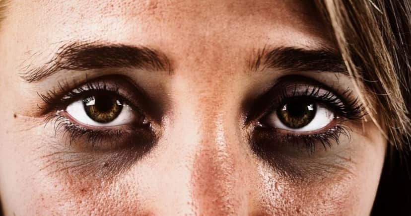 Olheiras podem ser amenizadas com isso (Foto: Divulgação)