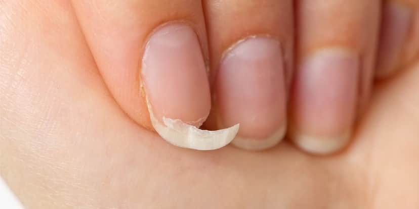 Unhas quebradas revertidas com papel higiênico (Reprodução: Divulgação) Unhas quebradas revertidas com papel higiênico (Reprodução: Divulgação)