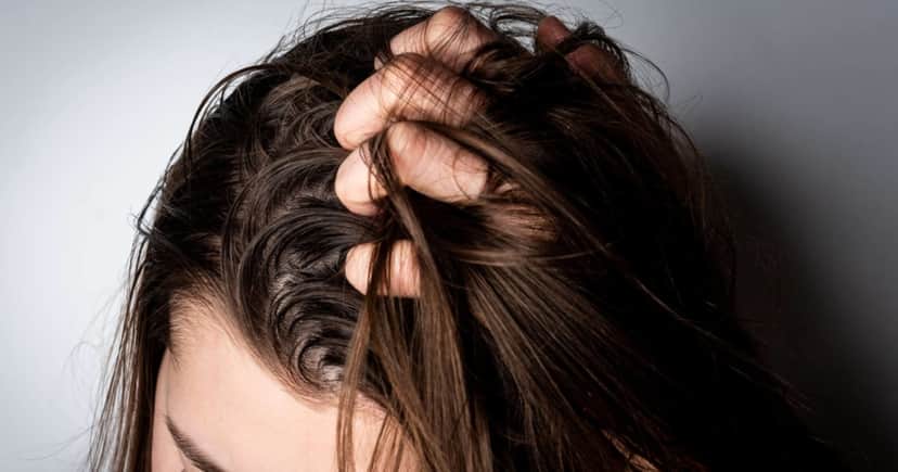 Cabelo sujo e com suor (Foto: Reprodução/Internet) Cabelo sujo e com suor (Foto: Reprodução/Internet)