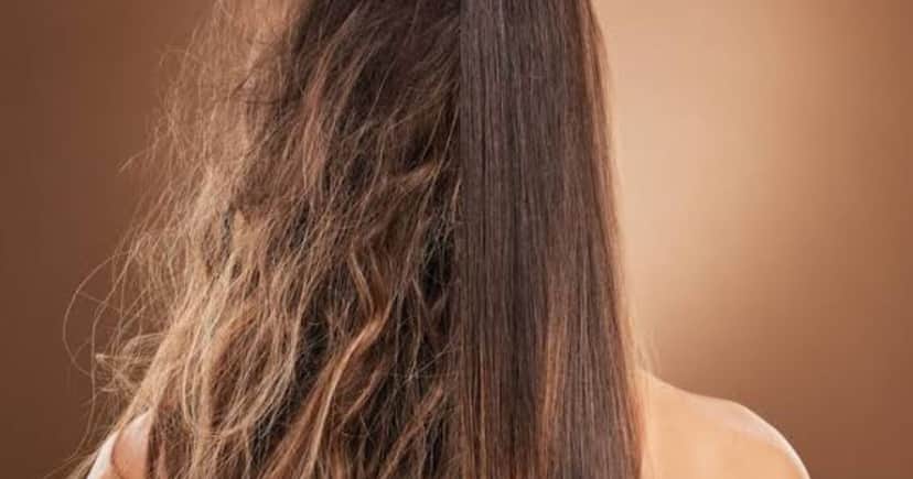 Cabelo com frizz (Foto: Reprodução/ Internet)
